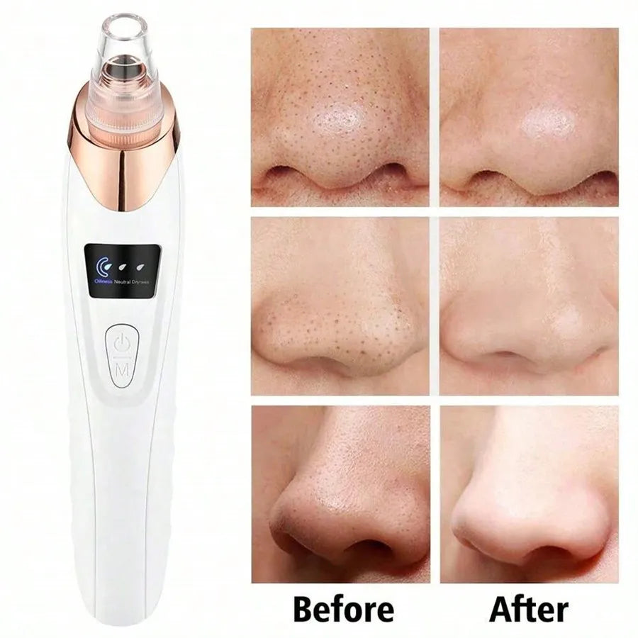 Electric Facial Pore Cleanser