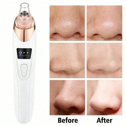 Electric Facial Pore Cleanser