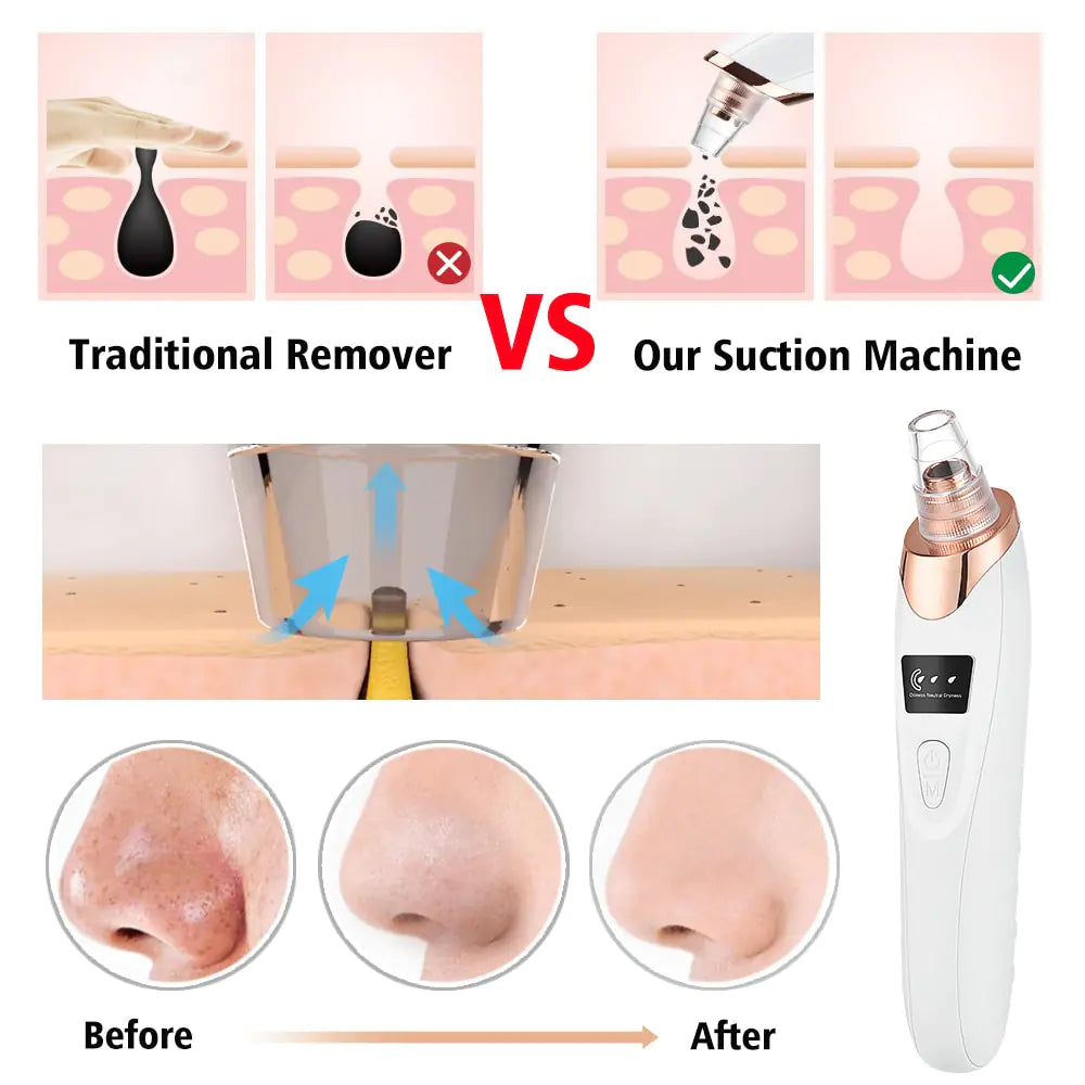 Electric Facial Pore Cleanser