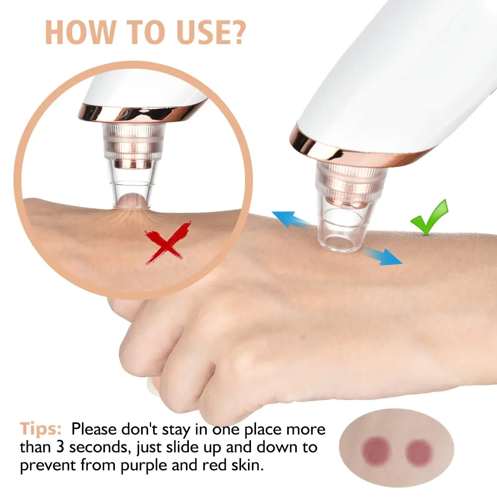 Electric Facial Pore Cleanser